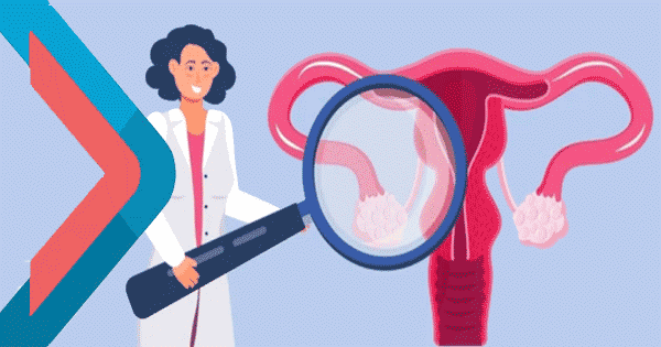 INFERTILITY PROFILE FEMALE (BASIC)