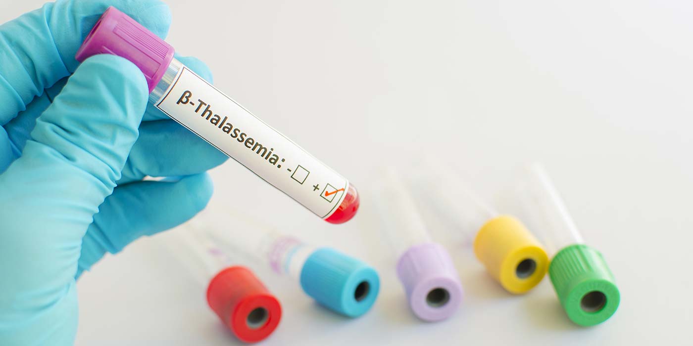 THALASSEMIA PROFILE